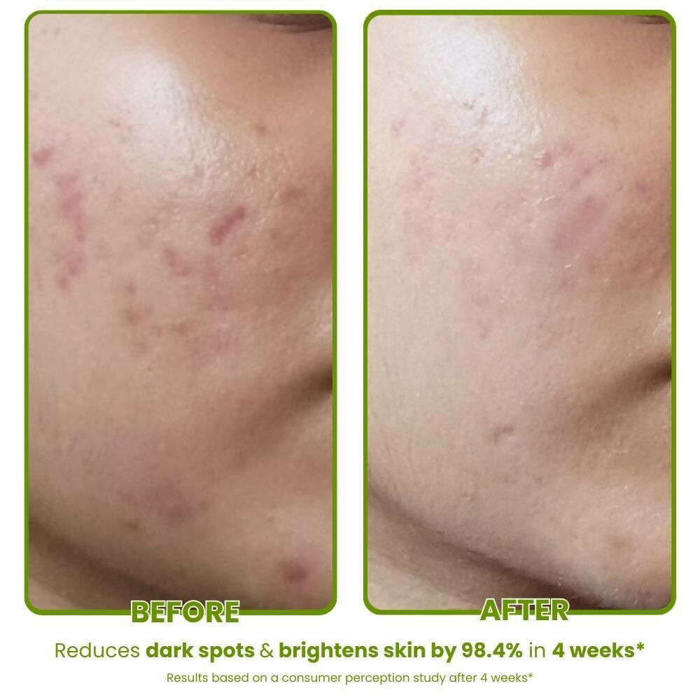 The Skin Diet Avocado Milky Glow Serum for Even Skin Tone with Hyaluronic Acid for Dull Skin