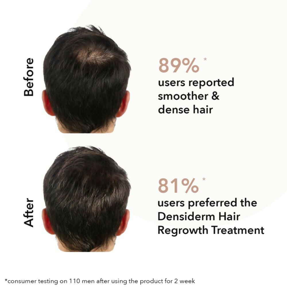 Professional O3+ Men Densiderm Anti Hair Loss Shampoo For Dense Hair & Regrowth