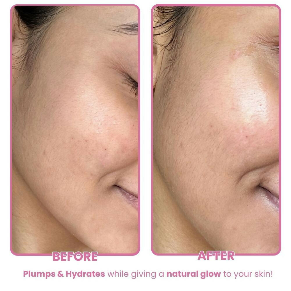 The Skin Diet Company Beetroot Moisturiser Lightweight, Non-Greasy - Dry/Oily Skin + Hyaluronic Acid