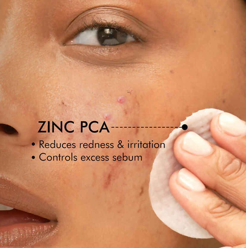 mCaffeine 2% Salicylic Acid Serum Clear Skin Acne Pads - Acne & Oil Control with Matcha Tea