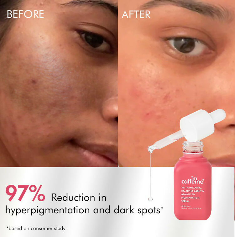 mCaffeine Clear Glow 3% Tranexamic, 2% Alpha Arbutin Advanced Pigmentation Serum
