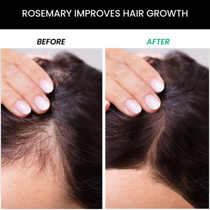 ThriveCo Rosemary Conditioner - Drmedicart