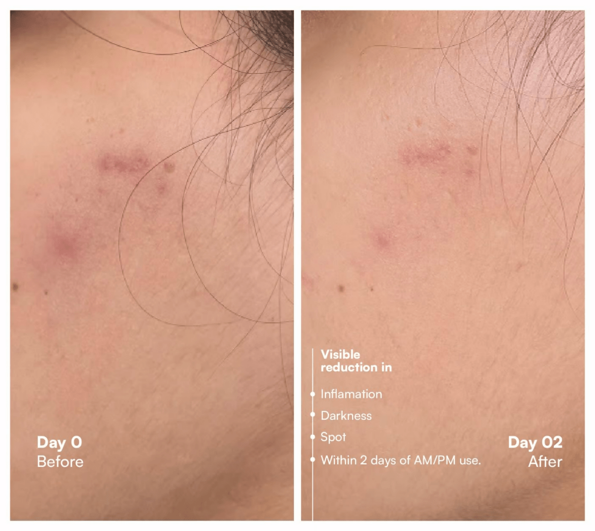 Awear Beauty Glass Skin Dual Spot Treatment