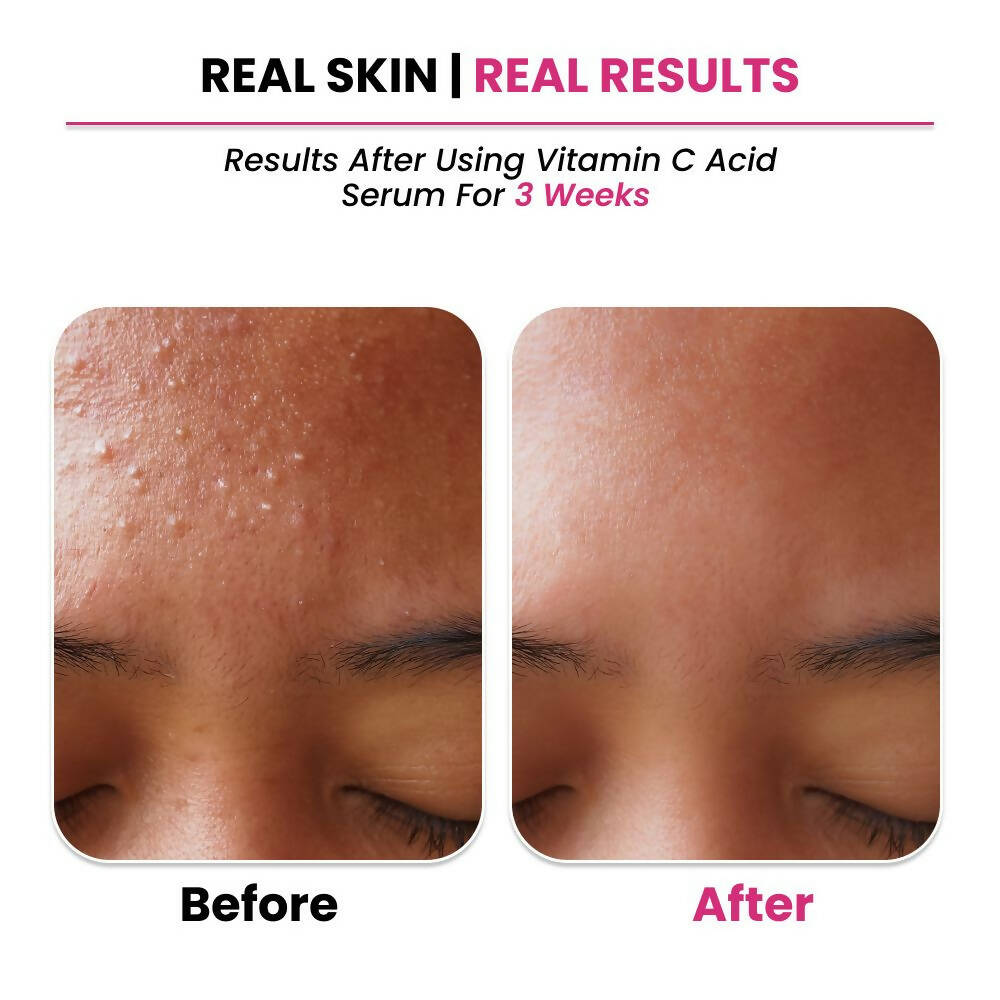 Buy Thriveco 10% Vitamin C+ Hyaluronic Acid Serum from DrMediCart, Ship from India to USA