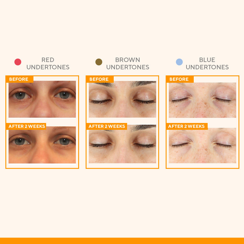 Murad Vitamin C Eyes Dark Circle Corrector