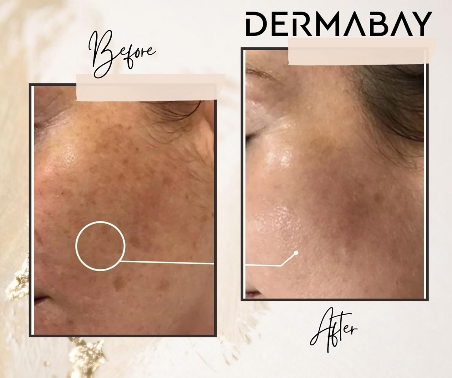 Dermabay Skin Brightening Face Serum With Kojic Acid & Alpha Arbutin