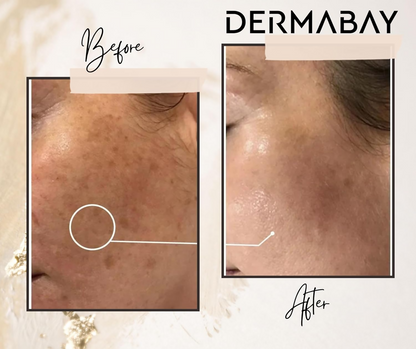 Dermabay Skin Brightening Face Serum With Kojic Acid & Alpha Arbutin