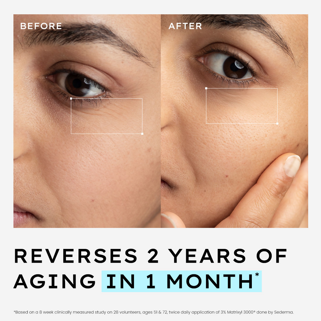 Hyphen 10% Power Peptide Cocktail Serum