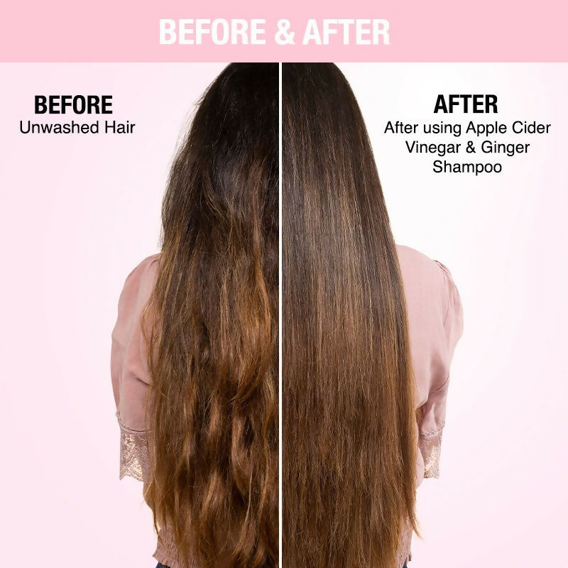 Nykaa Naturals Anti-Dandruff Shampoo - Drmedicart