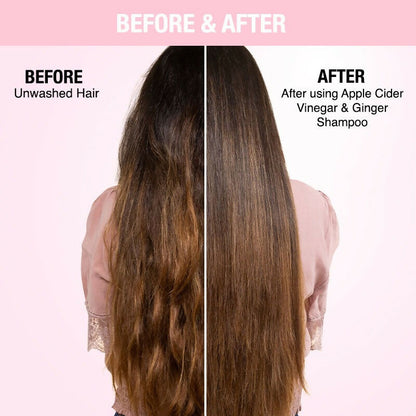 Nykaa Naturals Anti-Dandruff Shampoo - Drmedicart