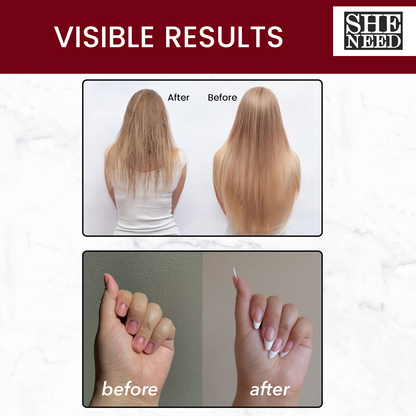 SheNeed Hair, Skin & Nails Vitamins Capsules