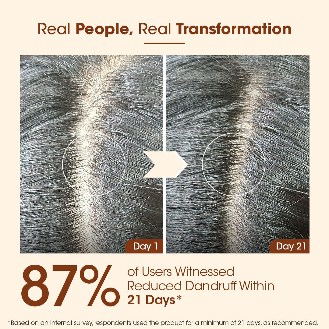 TAC - The Ayurveda Co. Methi, Bhringraj & Amla Hair Mask For Hair Growth with Natural Keratin