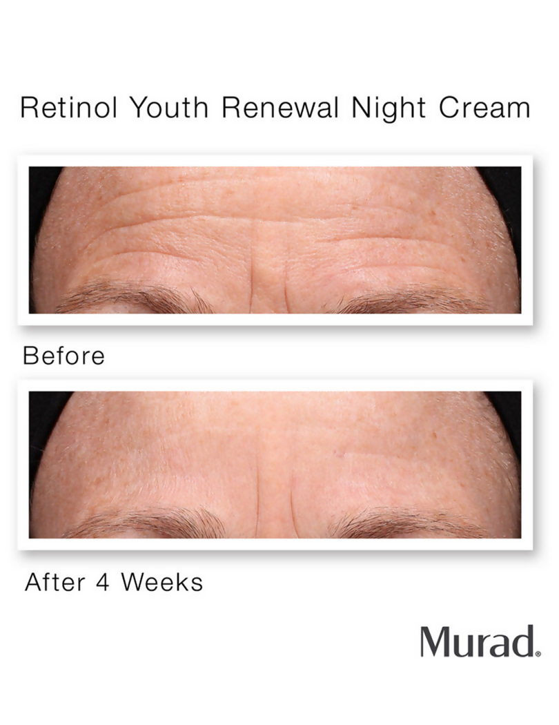 Murad Retinol Youth Renewal Night Cream