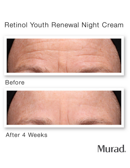 Murad Retinol Youth Renewal Night Cream