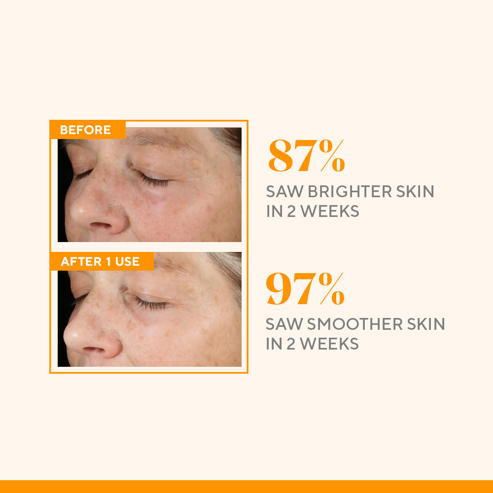 Murad Environmental Shield Vitamin C Triple Exfoliating Facial