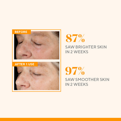 Murad Environmental Shield Vitamin C Triple Exfoliating Facial