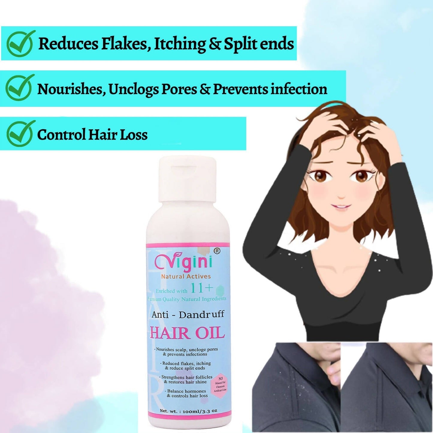 vigini anti dandruff itchy scalp hair care oil for men women anti hair fall buy in usa