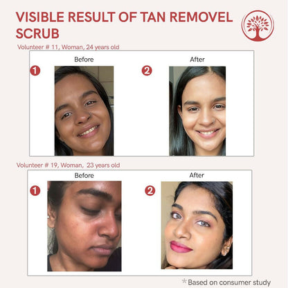 Ivory Natural Tan Scrub , Reduce Tan, Restores Radiant Skin Glow