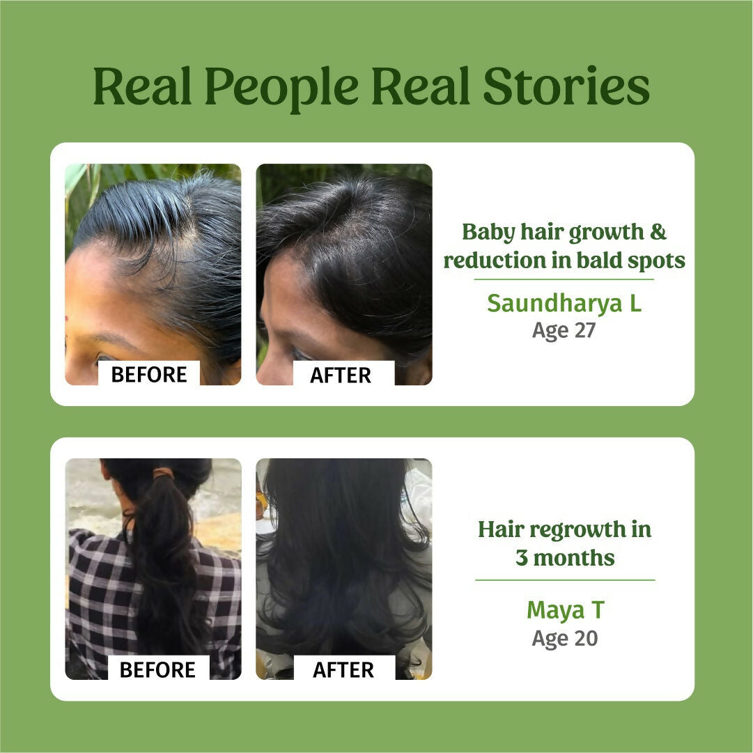 Vilvah Store Hair Growth Oil (Baby Hair Growth)