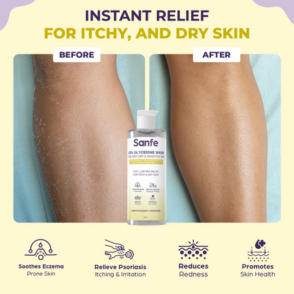Sanfe Eczema Relief Wash For Very Very Dry Skin