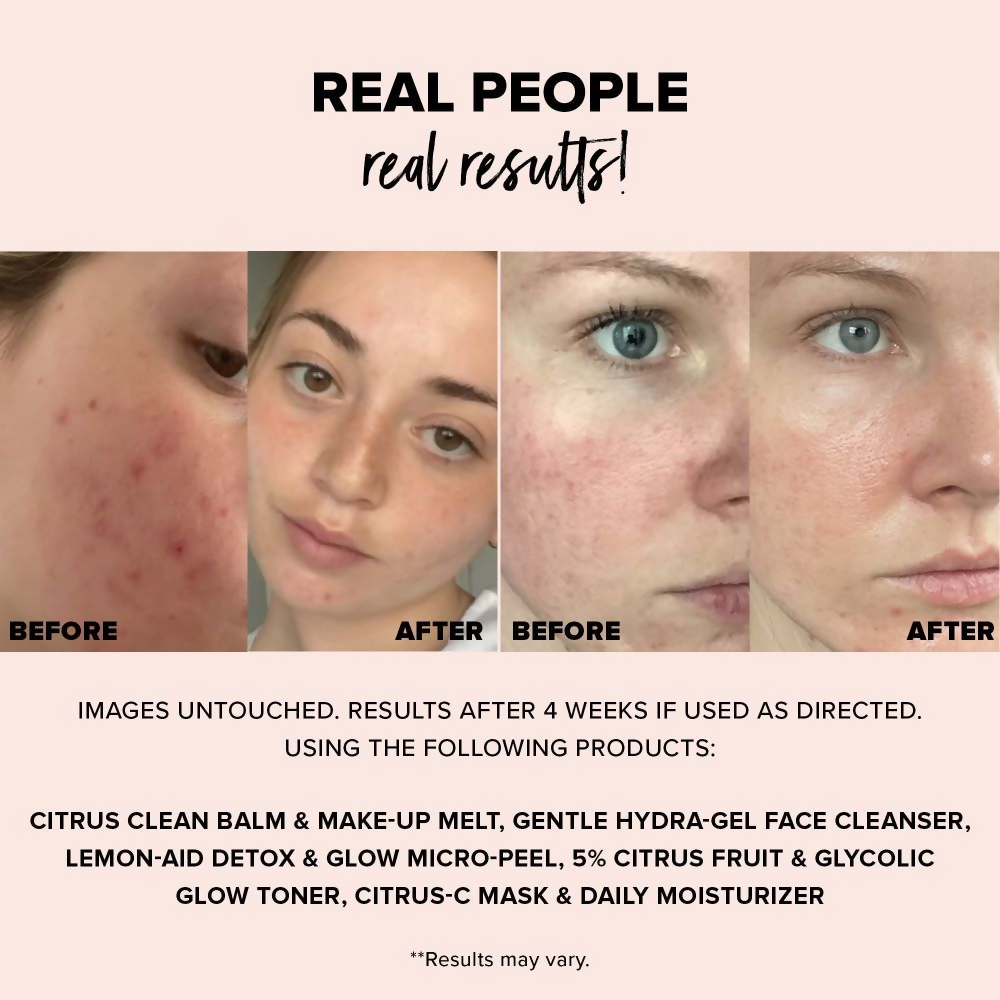 Nudestix Nudeskin Lemon-Aid Detox & Glow Micro-Peel