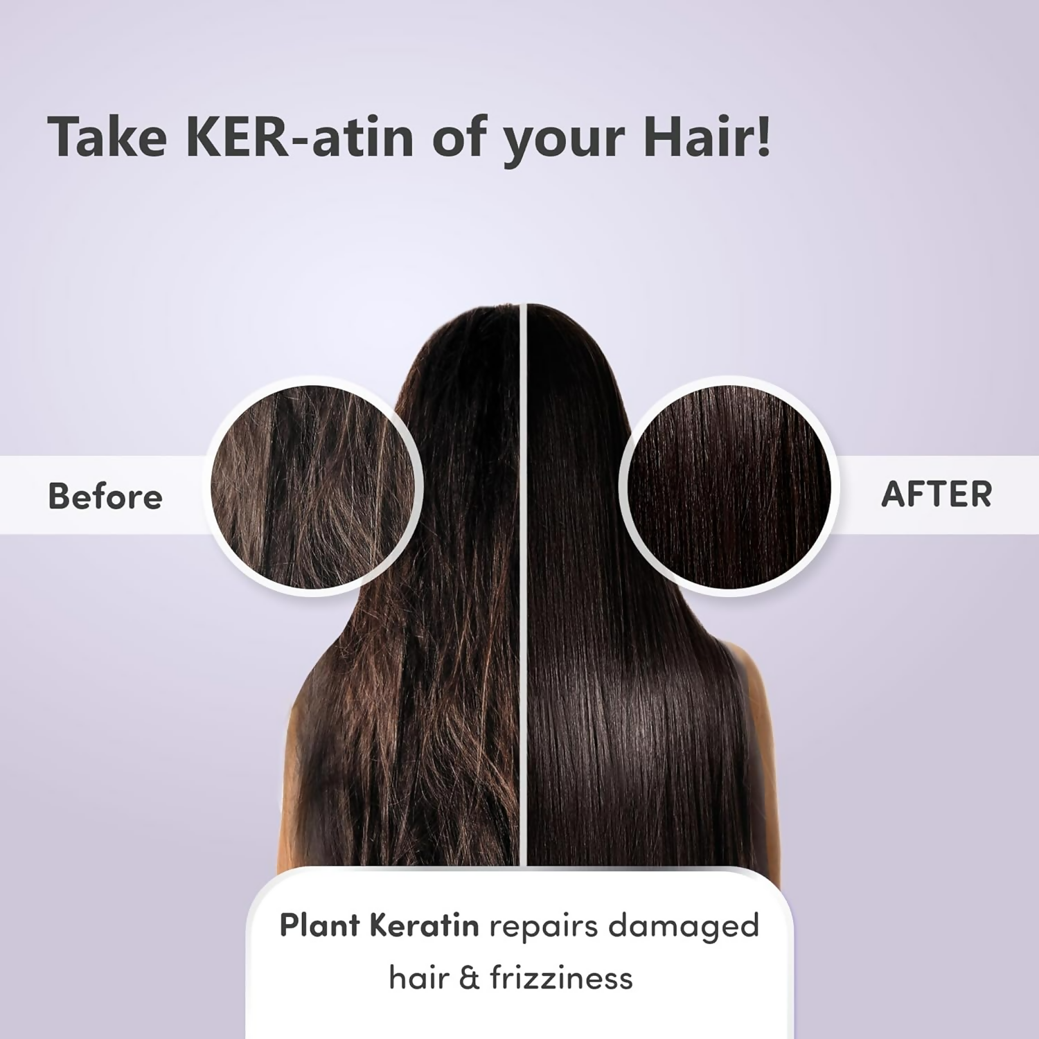 Mylo Care Anti Hair Fall Shampoo