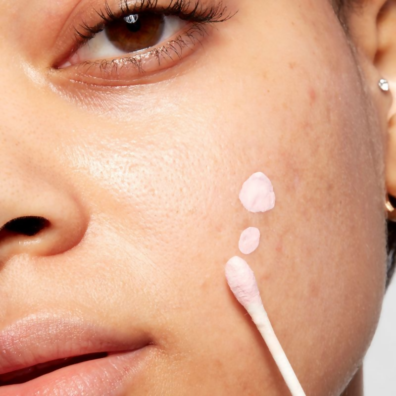 Mario Badescu Acne Spot Corrector Drying Lotion with Salicylic Acid