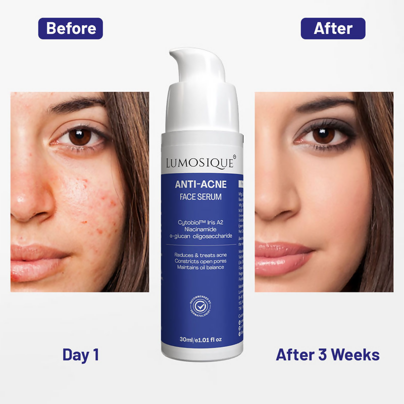 Lumosique Anti Acne Face Serum