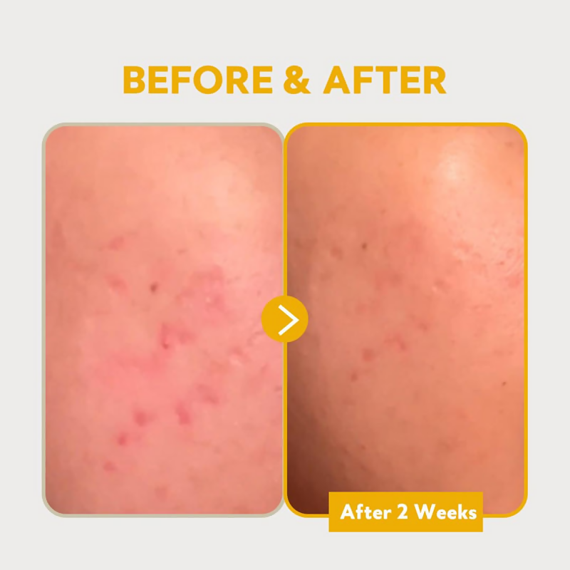 Tirtir Pure Vitamin C24 Serum