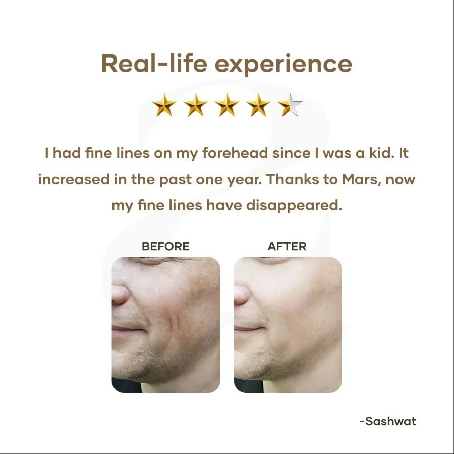 Mars By GHC Anti Aging Serum With Retinol