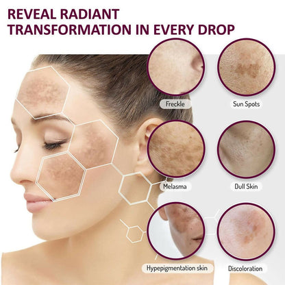 7 Days Dark Spot Reduction Serum