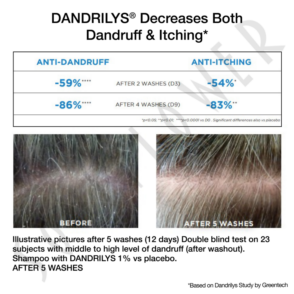 Soulflower Anti Dandruff Shampoo