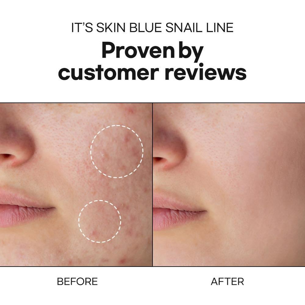 It's Skin Blue Snail Moisturizer