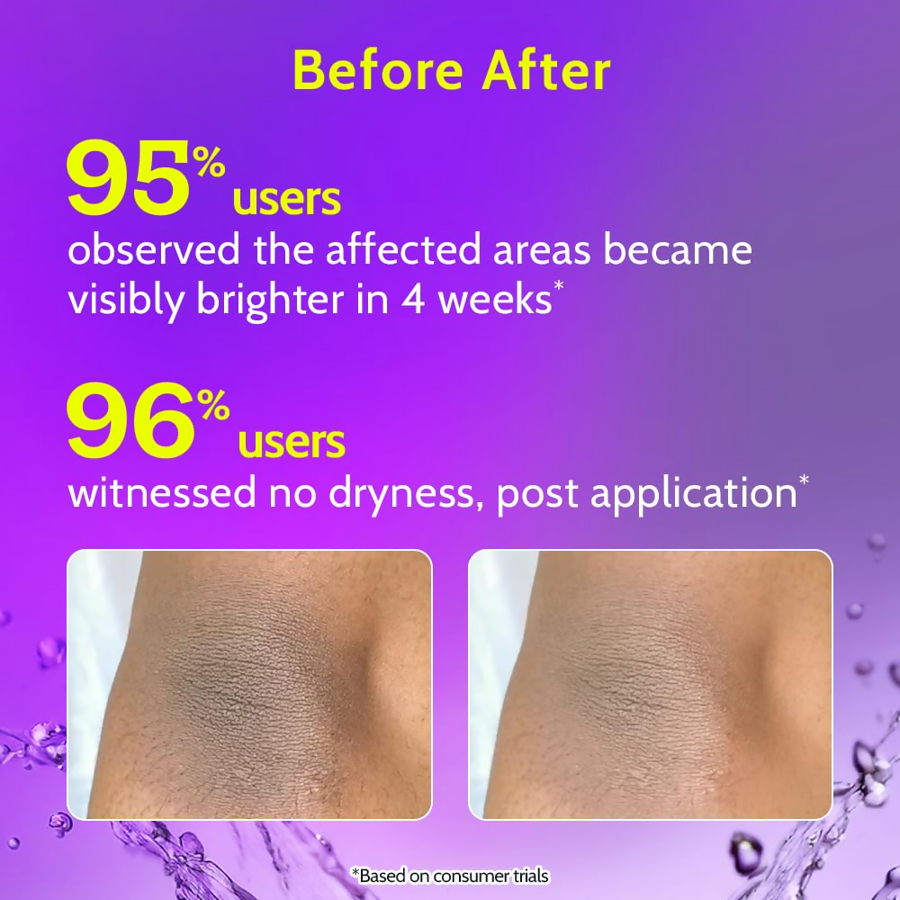 Chemist at Play Vitamin C Neck Knee Elbow Brightening Roll On for Men & Women