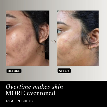 The Formularx Air Brush Facial All In One Lactic Acid Serum For Instant Radiance