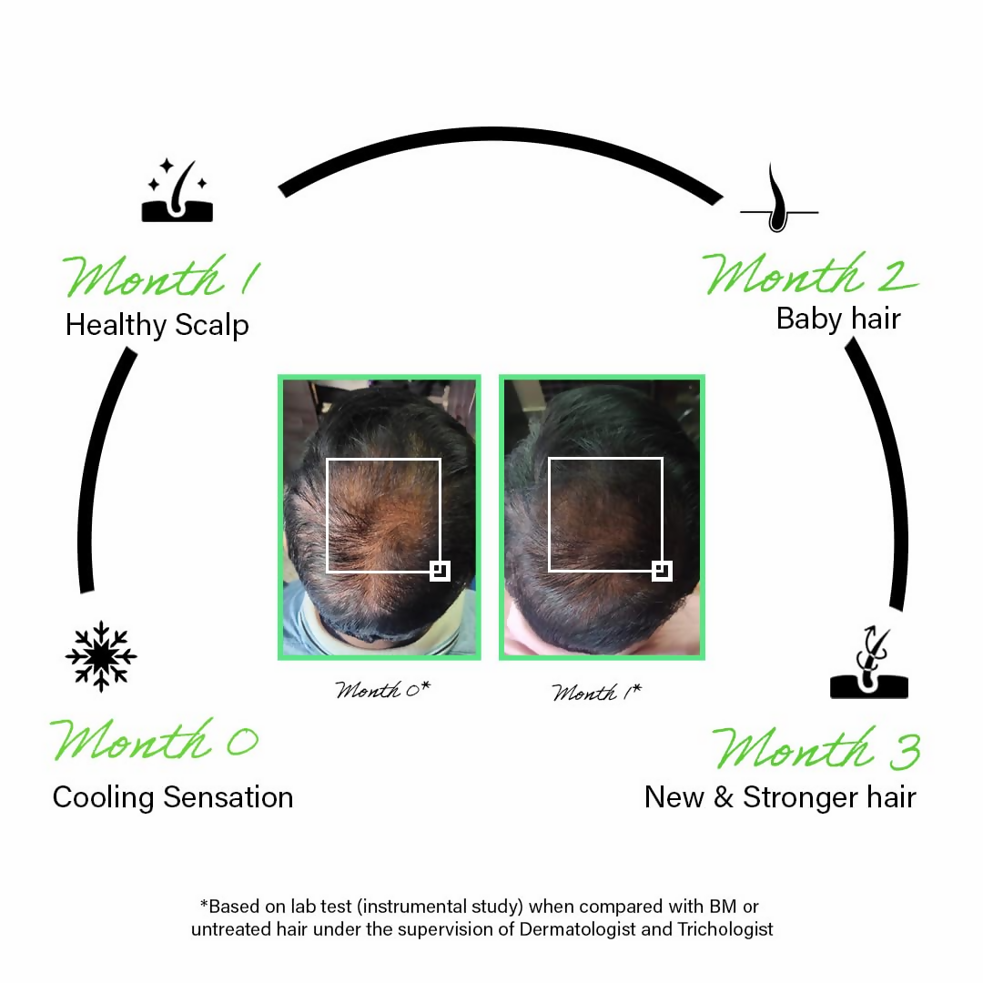 Rootcos Rosemary Hair Growth Serum