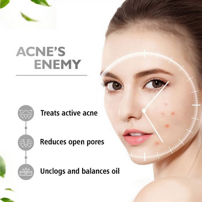 The Beauty Sailor Active Acne Face Serum