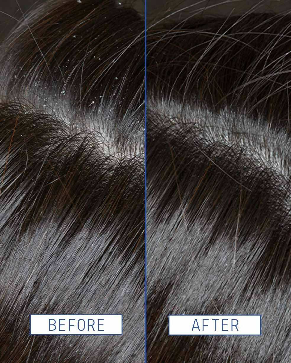Aavrani Scalp Rescue Serum - DrMediCart