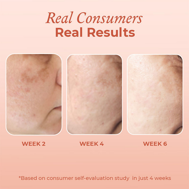 The Pink Foundry Dark Spot & Hyperpigmentation Face Serum