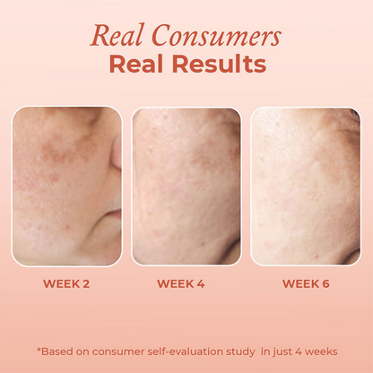 The Pink Foundry Dark Spot & Hyperpigmentation Face Serum
