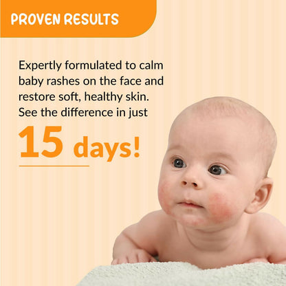 Fixderma Hoopoe Baby Anti-Rash Face Cream