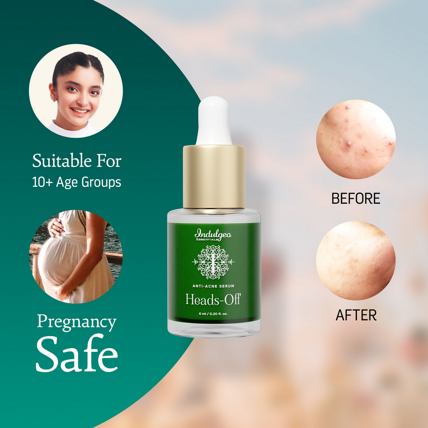 Indulgeo Essentials Heads Off Anti Acne Face Serum