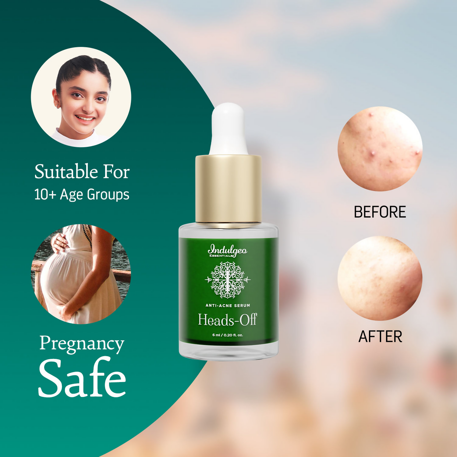 Indulgeo Essentials Heads Off Anti Acne Face Serum