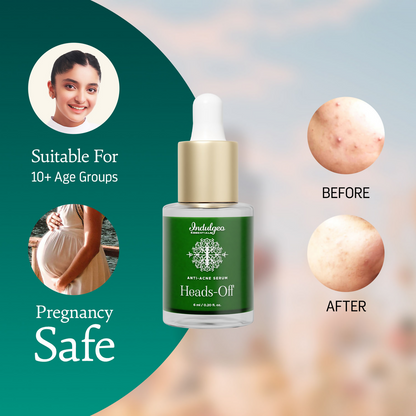 Indulgeo Essentials Heads Off Anti Acne Face Serum