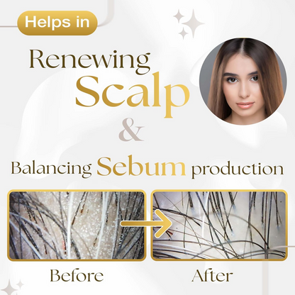 Siya Ayurveda Scalp Exfoliating Serum