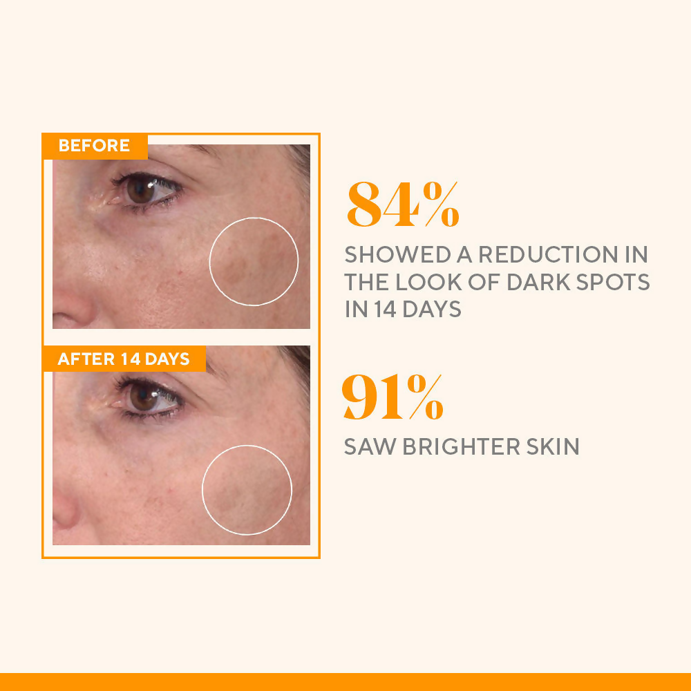 Murad Rapid Dark Spot Correcting Serum