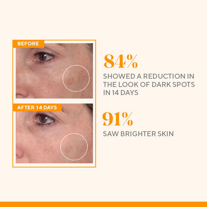 Murad Rapid Dark Spot Correcting Serum