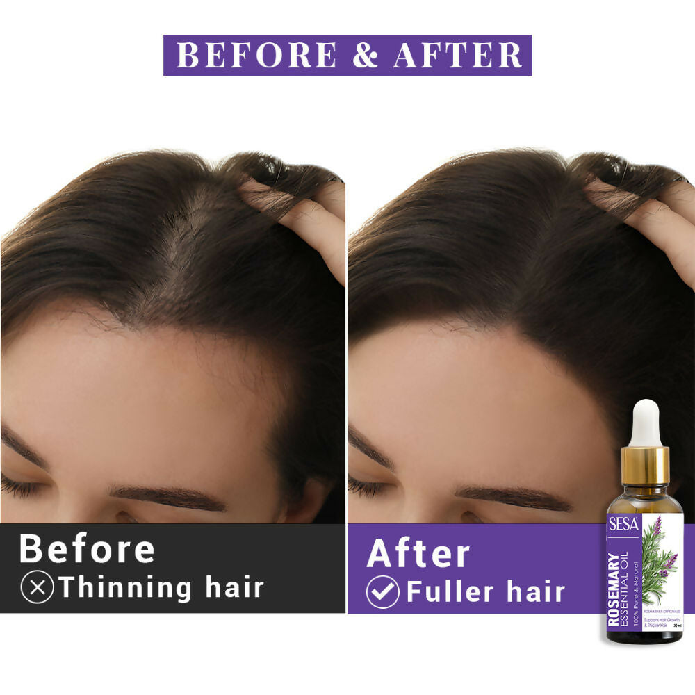 Sesa Ayurvedic Rosemary Essential Oil For Hair Growth