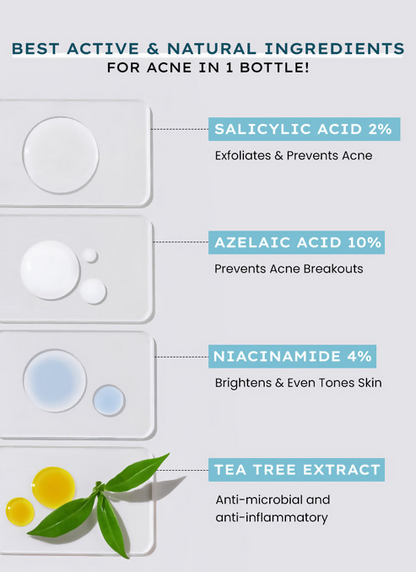 Hyphen By Kriti Sanon Acne Defence Daily Serum With 2% Salicylic Acid Treats Active Acne Prevents Breakouts