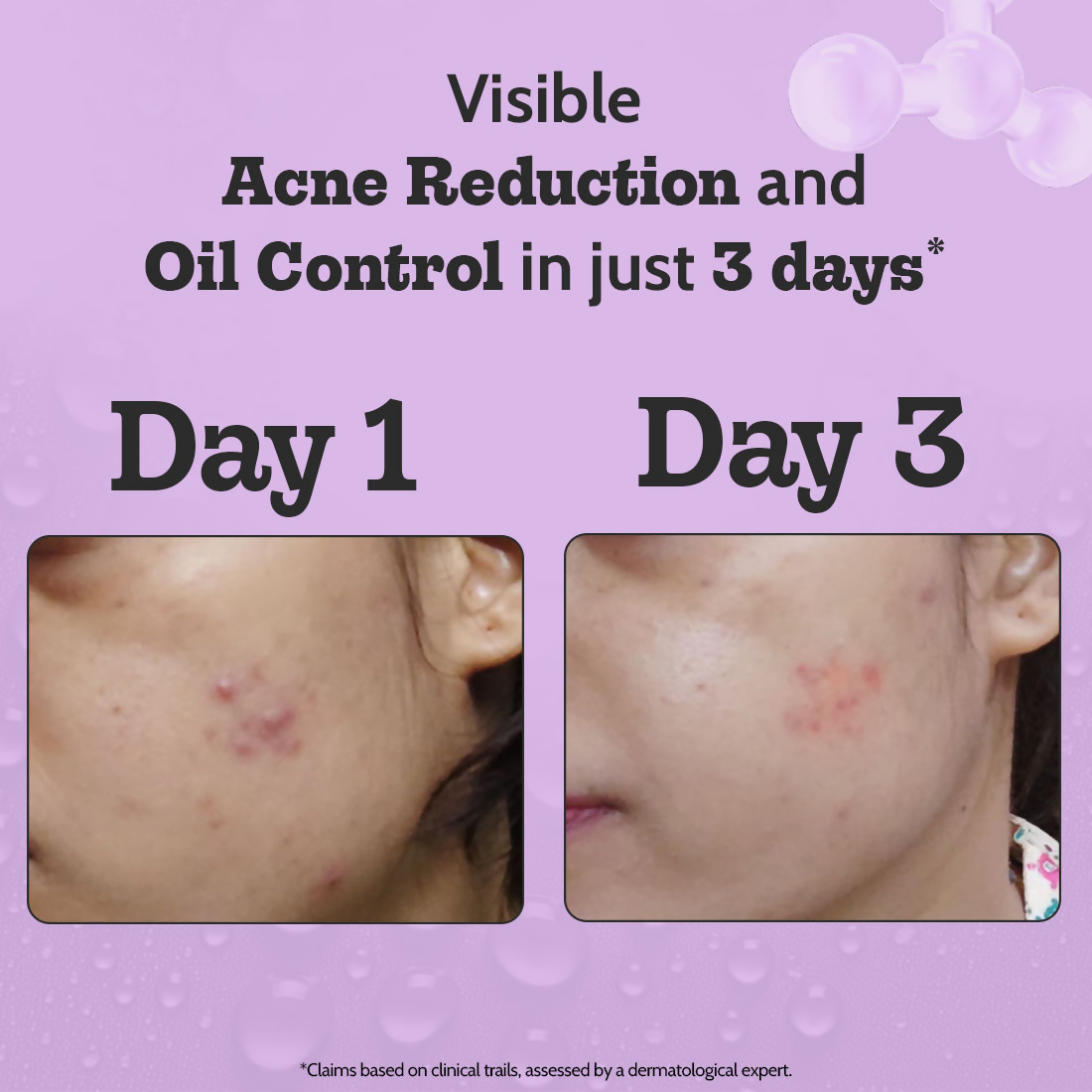 Chemist At Play 2% Salicylic Acid Face Serum